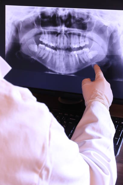 Tooth Infection Emergency Dentist in CO