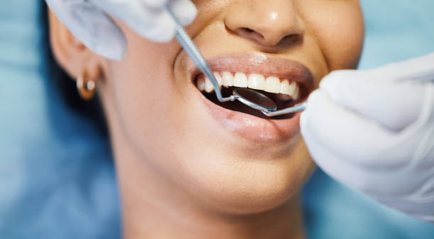 Best Emergency Tooth Extraction  in Breckenridge, CO